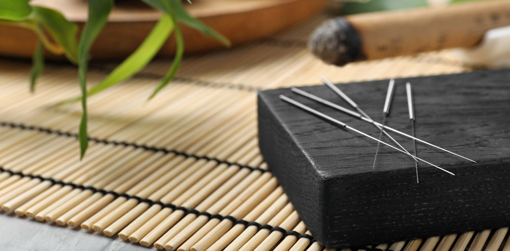acupuncture therapy treatment session for pain relief and healing